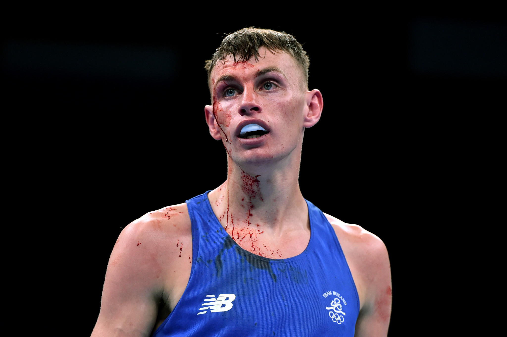 Sean McComb cuts a bloodies figure during a bout ©Getty Images