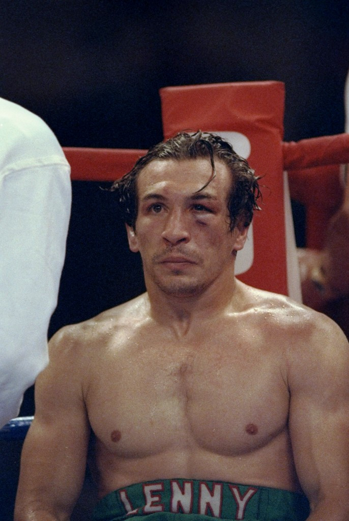 Ray Mancini, pictured, was never the same fighter again after Duk-koo Kim passed away