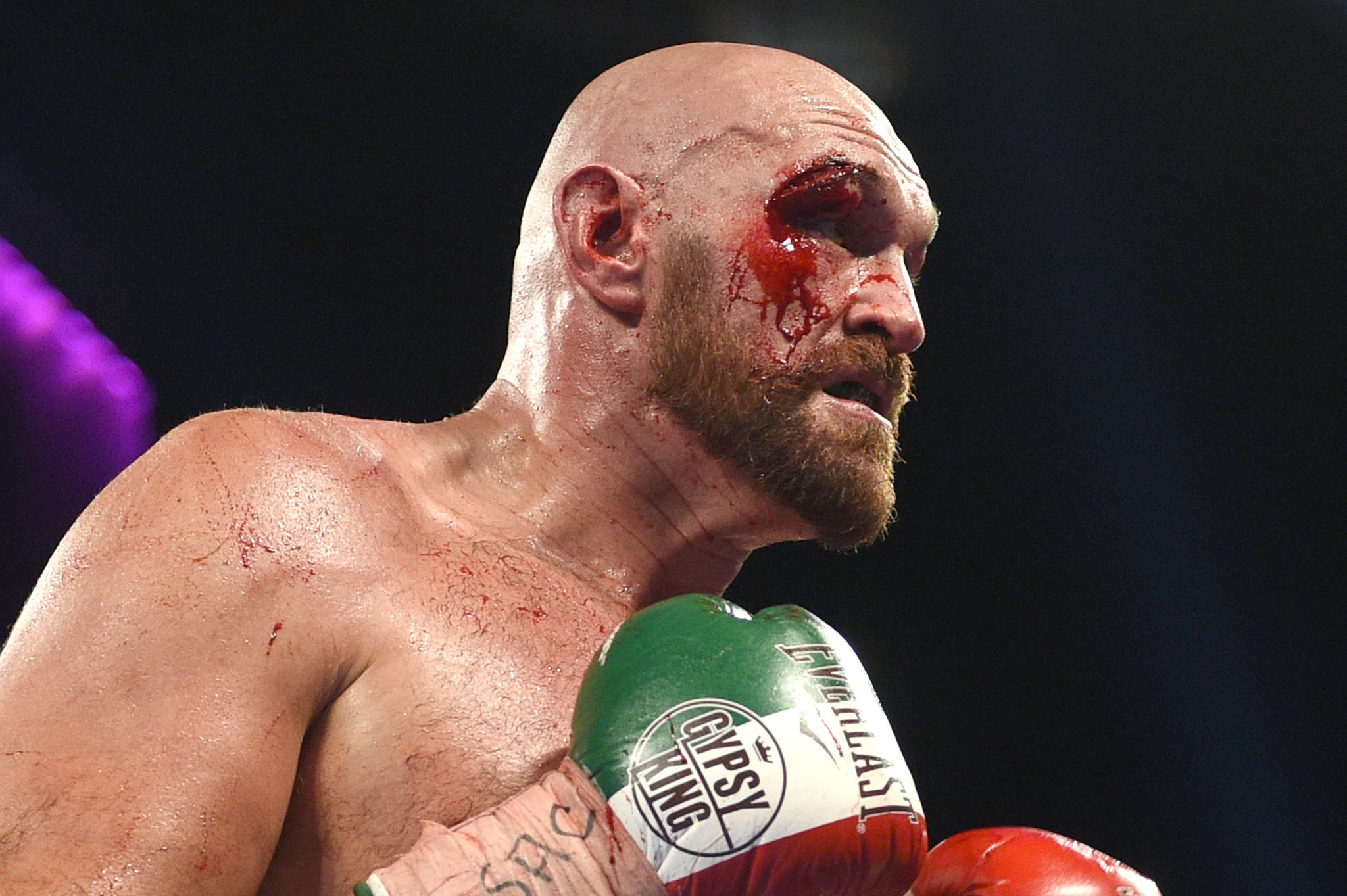 Tyson Fury suffered a deep cut during his fight with Sweden's Otto Wallin last weekend ©Getty Images