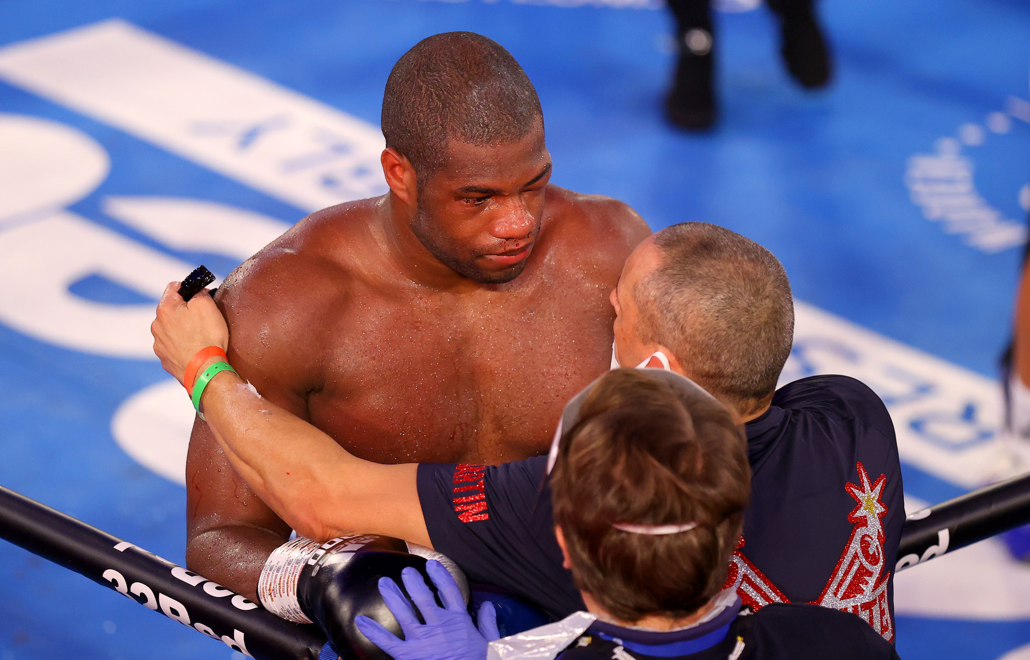 The eye injury that led to Daniel Dubois retirement against Joe Joyce is a recent example of the brutal side of boxing ©Getty Images