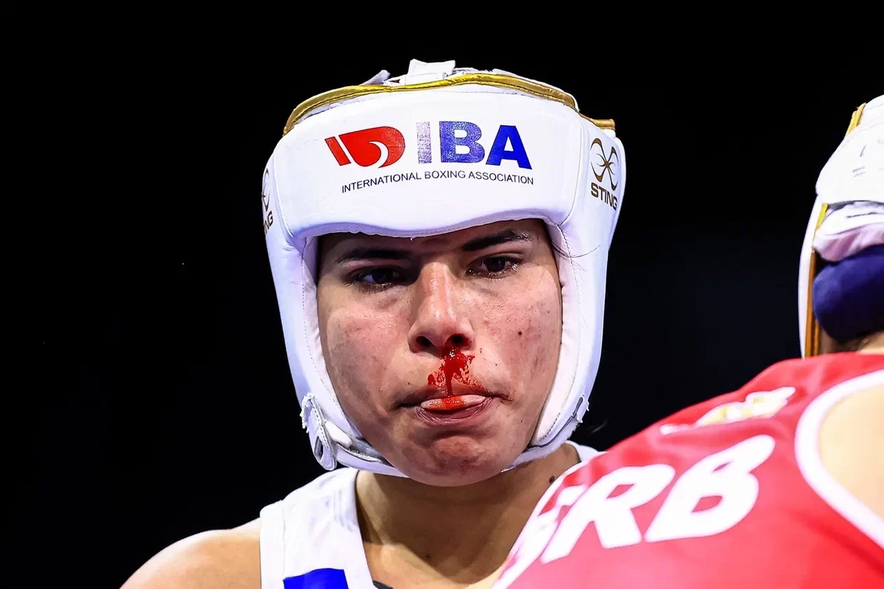 Argentina's Viviana Palavecino's bout was ended early after it was deemed she was injured ©IBA