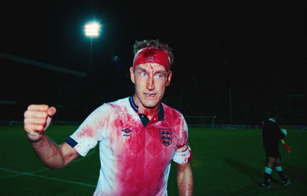 A bloodsoaked Terry Butcher after England's goalless draw with Sweden ©Getty Images