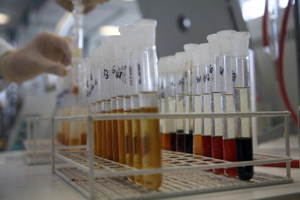 Doping remains as one of the most pressing issues in sport