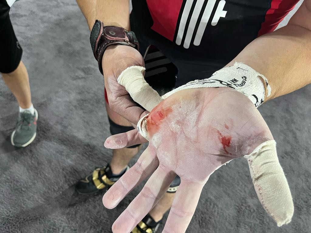 Boady Santavy said he felt the skin tear on his hand after his last snatch ©IWF