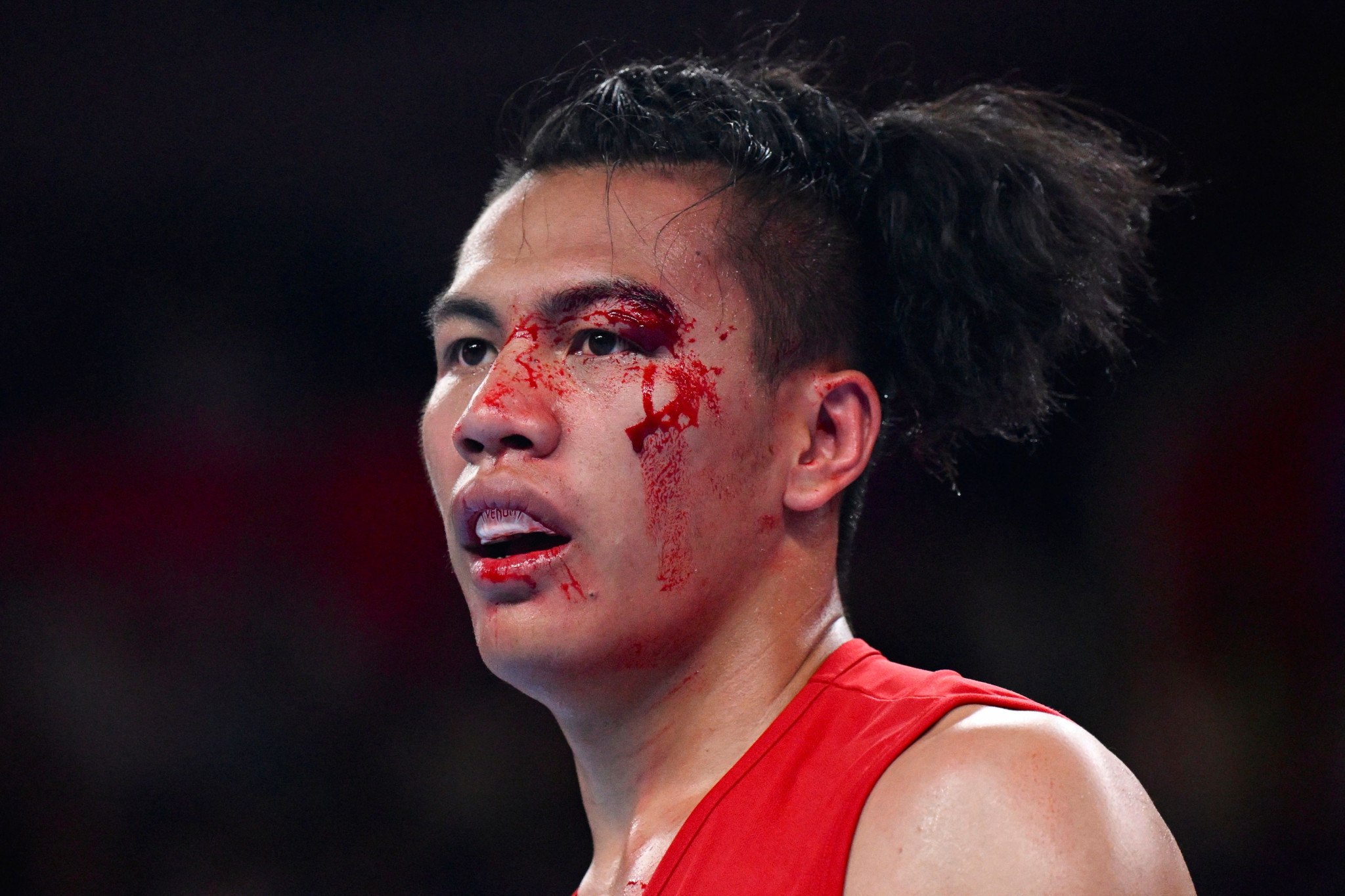 Boxer forced to concede gold medal fight due to facial injury at Hangzhou 2022