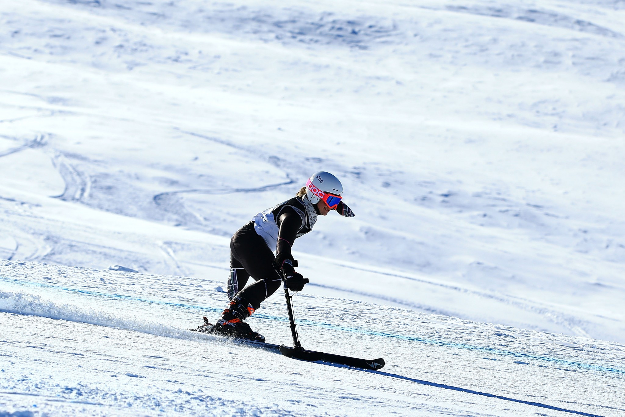Skier postpones surgery in bid to keep Paralympic bid alive